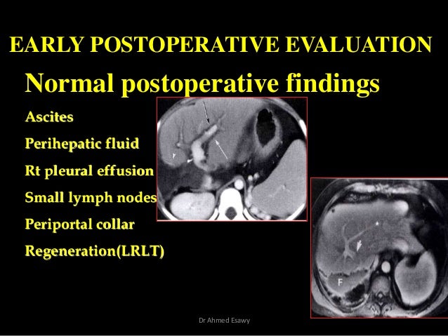 Imaging in Transplantation